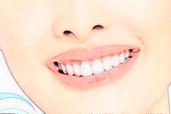 2024成都新橋口腔醫(yī)院矯正牙齒價格?矯正牙齒痛不痛?