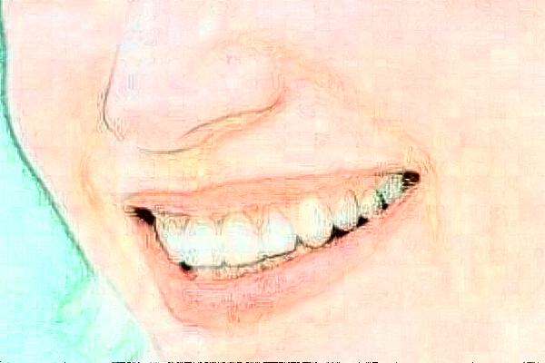 2024山東鉑爾口腔全瓷牙哪個醫(yī)生好?專家名單+案例反饋