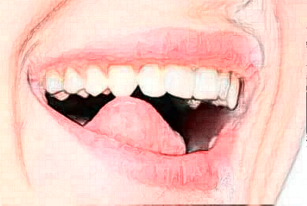 淮安諾貝爾口腔醫(yī)院全口種植怎么樣，附醫(yī)生信息一覽~