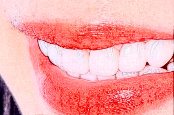 2024淮安諾貝爾口腔醫(yī)院根管好不好?附術(shù)后案例參考!