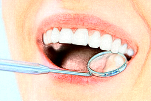 福州福能海峽口腔醫(yī)院冷光美白多少錢_案例反饋