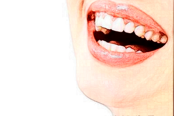 贛州貝殼口腔矯正牙齒怎么收費?哪個醫(yī)生做得好