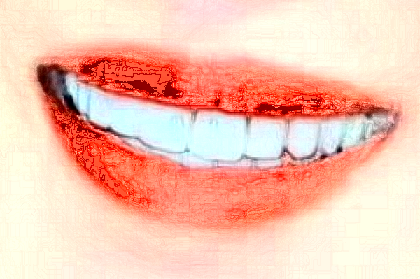 2024福州美橙口腔地包天矯正怎么樣，附醫(yī)生信息一覽~