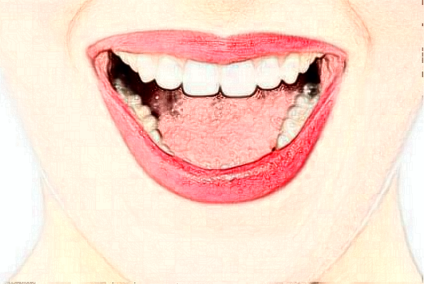 天津南開醫(yī)院前牙種植費(fèi)用多少_醫(yī)生名單