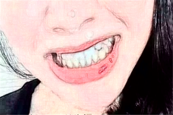 北京牙管家口腔診所超聲波洗牙怎么樣|醫(yī)生介紹|價(jià)格收費(fèi)