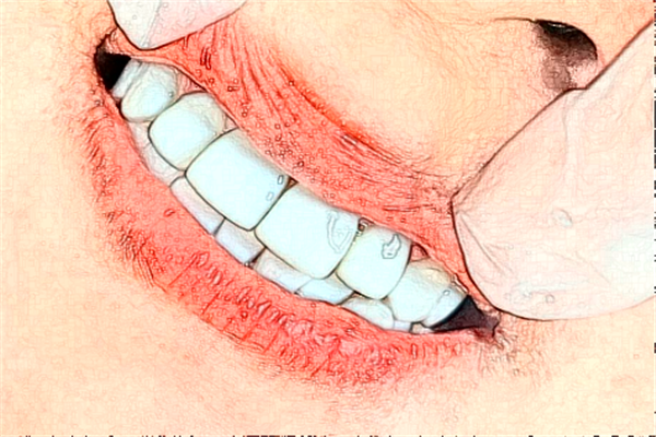 2024太原眾牙口腔醫(yī)院補(bǔ)牙多少錢?做的怎么樣