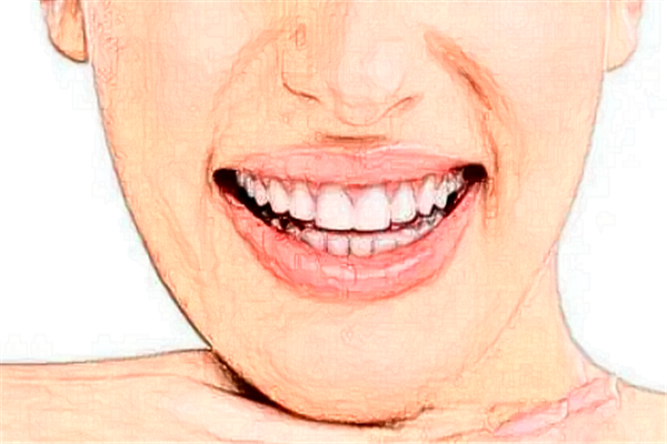 成都圣貝牙科醫(yī)院美容冠價(jià)格多少?整形日記全過程分享