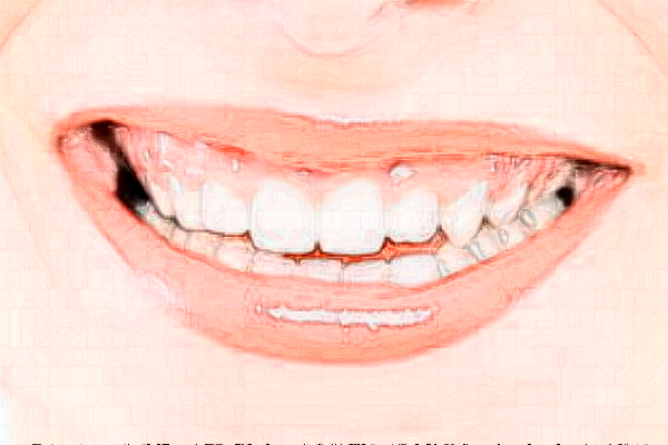 2024鄭州唯美口腔醫(yī)院瓷貼面整形案例_專家介紹