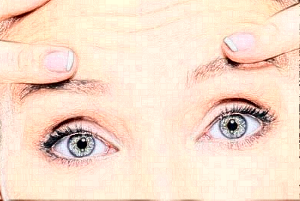 2024遼寧省人民醫(yī)院全飛秒費(fèi)用多少?整形日記全過(guò)程