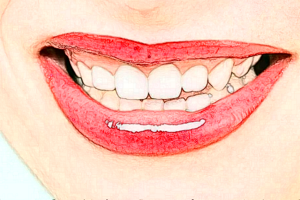 2024義烏傅氏口腔門診部噴砂洗牙價格?噴砂洗牙的危害