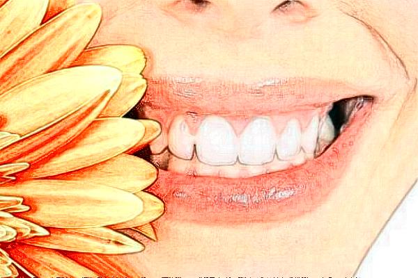 宣城大醫(yī)醫(yī)院種植牙的特點?種植牙的種植體系