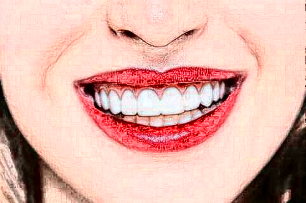 2024淮安諾貝爾口腔醫(yī)院瓷貼面哪個(gè)醫(yī)生好?專(zhuān)家名單+案例反饋