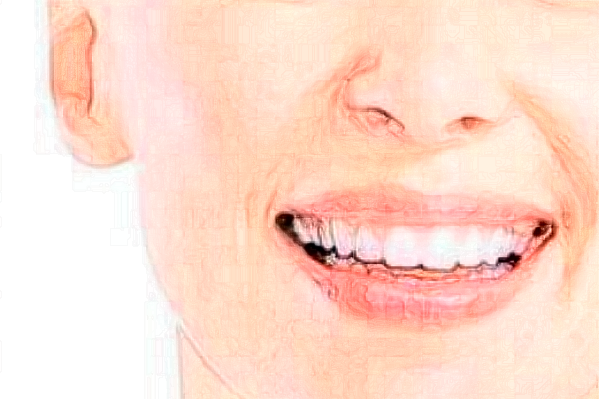 2024淮安諾貝爾口腔醫(yī)院瓷貼面哪個(gè)醫(yī)生好?專(zhuān)家名單+案例反饋