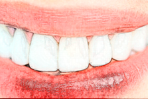 長沙科爾雅口腔醫(yī)院補(bǔ)牙做的好嗎?哪位醫(yī)生做得好