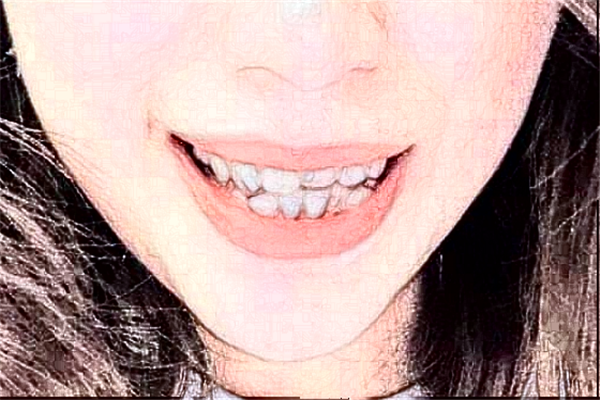 長沙好大夫口腔醫(yī)院牙齒修復(fù)多少錢?做的怎么樣