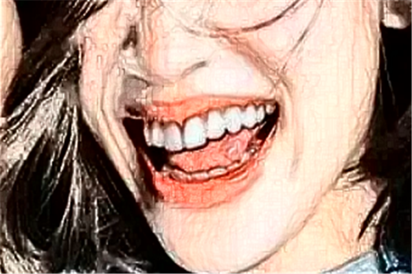 北京牙管家口腔診所冷光美白費(fèi)用多少?整形日記全過(guò)程