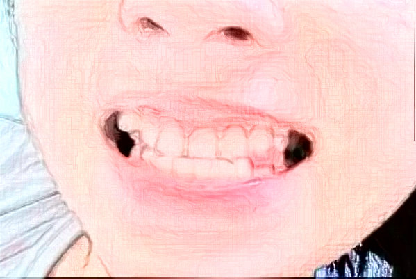 深圳樂(lè)莎莎口腔醫(yī)院醫(yī)生怎么樣?2024牙齒矯正怎么收費(fèi)