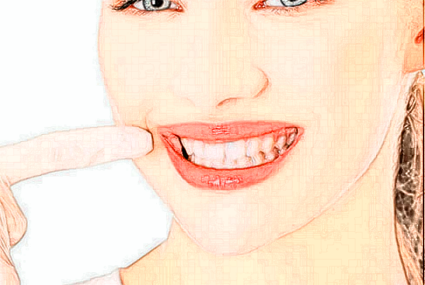 2024河南美奧口腔醫(yī)院拔牙價格表?拔牙后的注意事項(xiàng)