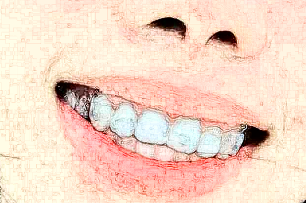 成都新橋口腔醫(yī)院根管貴不貴?2024根管費用