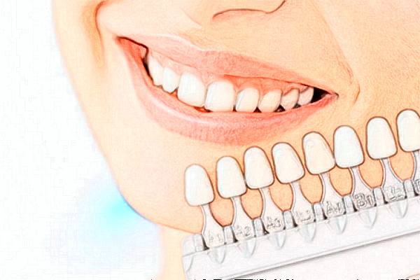 2024深圳樂(lè)莎莎口腔醫(yī)院隱形矯正價(jià)格?隱形矯正的優(yōu)點(diǎn)