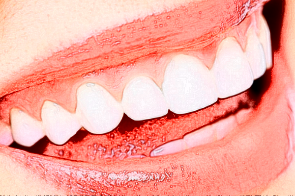 2024深圳樂(lè)莎莎口腔醫(yī)院隱形矯正價(jià)格?隱形矯正的優(yōu)點(diǎn)