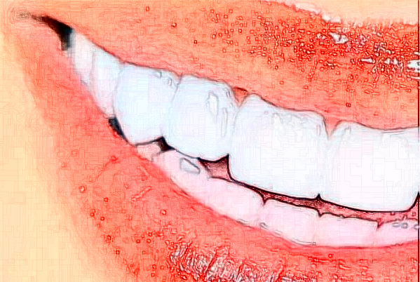 2024貴陽(yáng)柏德口腔醫(yī)院前牙種植費(fèi)用多少?整形日記全過(guò)程