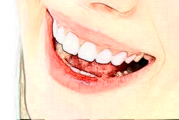 2024貴陽(yáng)柏德口腔醫(yī)院前牙種植費(fèi)用多少?整形日記全過(guò)程