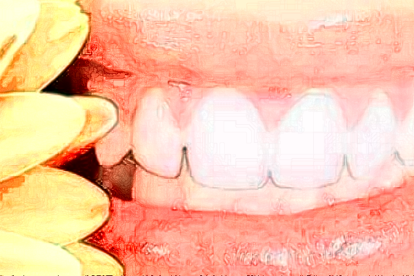 長(zhǎng)沙科爾雅口腔醫(yī)院隱適美案例_專家介紹