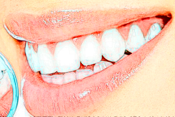 2024襄陽新德恩口腔門診部牙齒矯正費(fèi)用多少_真實(shí)案例反饋