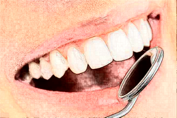 福州福能海峽口腔醫(yī)院正畸價(jià)目表(價(jià)格表)怎么樣