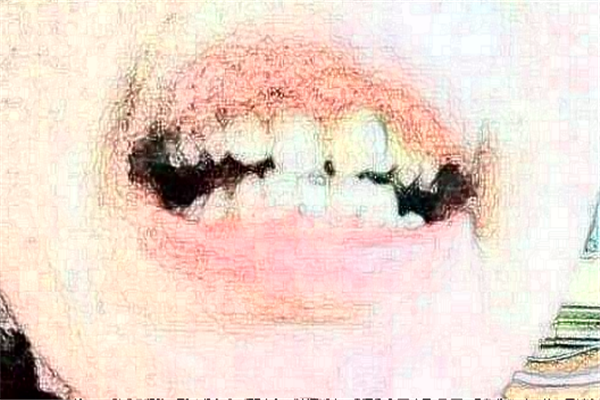 2024貴陽(yáng)柏德口腔醫(yī)院齙牙矯正怎么樣_體驗(yàn)日記分享