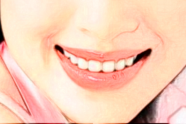 2024河南美奧口腔醫(yī)院矯正牙齒價格表?矯正牙齒有多疼