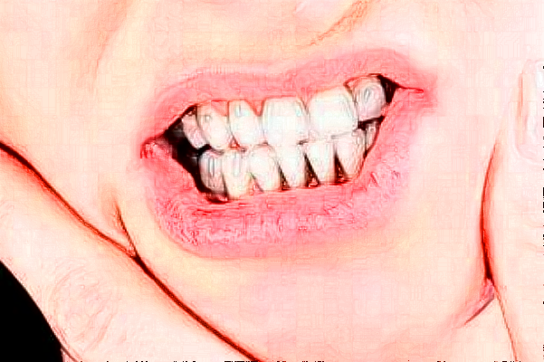 重慶團(tuán)圓口腔醫(yī)院正畸到底好不好?2024正畸牙齒的費用