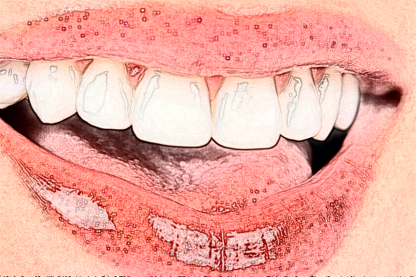 2024義烏傅氏口腔門診部根管費(fèi)用?根管好嗎