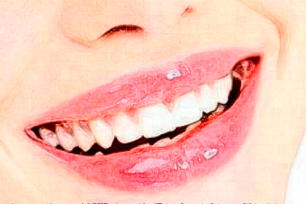 義烏傅氏口腔門(mén)診部拔牙痛不痛?拔牙需要多少時(shí)間