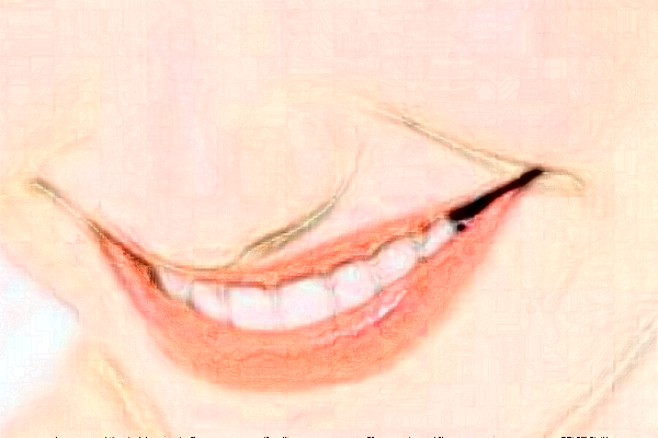 義烏傅氏口腔門(mén)診部拔牙痛不痛?拔牙需要多少時(shí)間