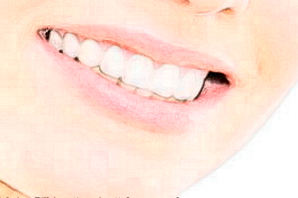 義烏傅氏口腔門診部整牙好么?2024整牙要花多少錢