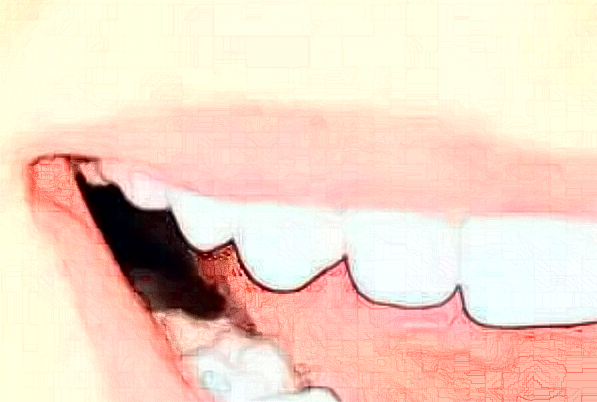 贛州貝殼口腔口腔修復(fù)怎么樣，附醫(yī)生信息一覽~