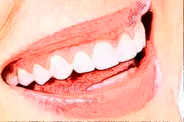 贛州貝殼口腔拔牙怎么樣，附醫(yī)生信息一覽~