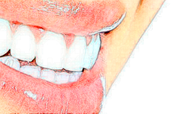 杭州植得口腔門診部前牙種植怎么樣?醫(yī)生介紹_案例分享