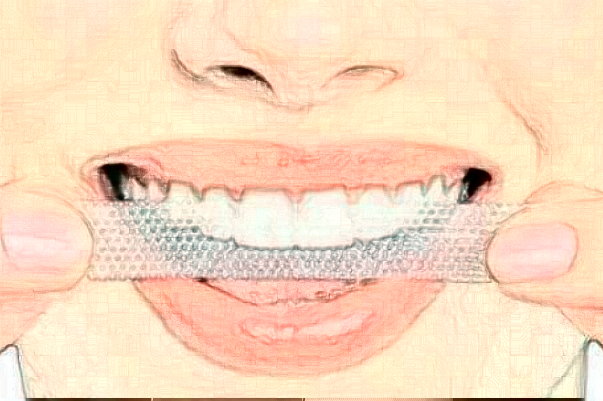 2024襄陽(yáng)新德恩口腔門(mén)診部美容冠好嗎_真實(shí)案例發(fā)布