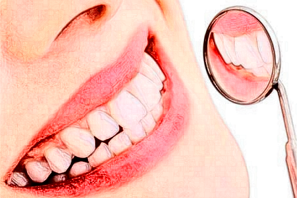 鄭州唯美口腔醫(yī)院冷光美白多少錢?做的怎么樣