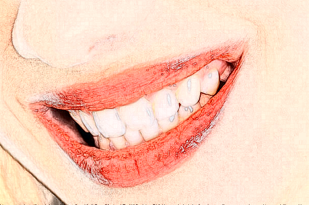 福州美橙口腔正畸案例,醫(yī)生推薦+價格表!