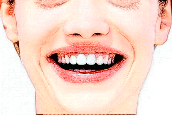 2024福州登特口腔醫(yī)院正畸怎么樣_體驗日記分享