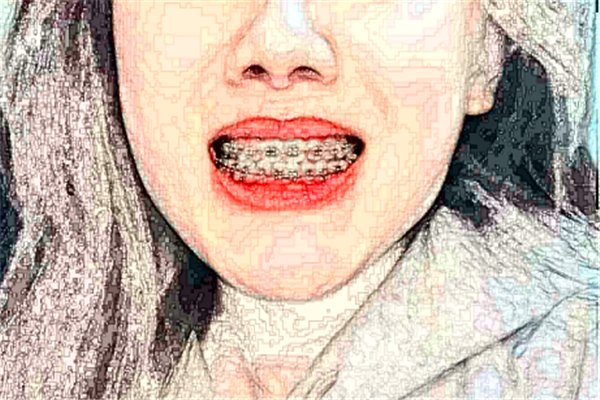 2024貴陽柏德口腔醫(yī)院瓷貼面怎么樣_專家信息_案例大全欣賞