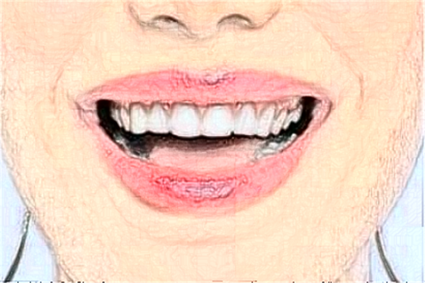 福州登特口腔醫(yī)院補牙好的大夫?醫(yī)生簡介