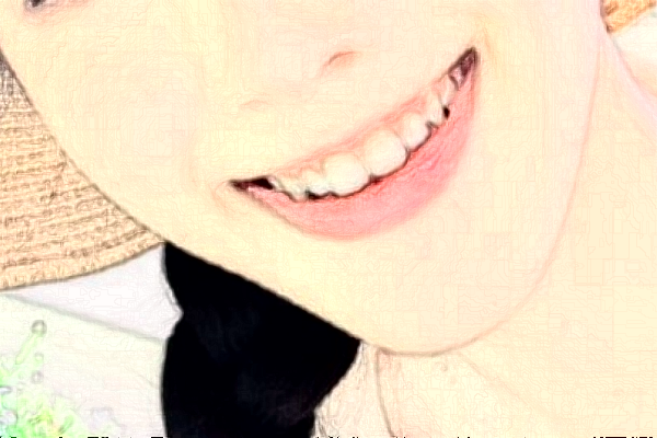 淮安諾貝爾口腔醫(yī)院隱形矯正怎么樣，附醫(yī)生信息一覽~