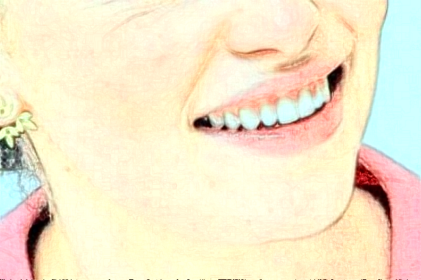 淮安諾貝爾口腔醫(yī)院隱形矯正怎么樣，附醫(yī)生信息一覽~