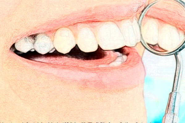 2024重慶齊美口腔門診部錯位畸形固定怎么樣_專家信息_案例大全欣賞