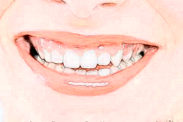 貴陽柏德口腔醫(yī)院全口種植價(jià)目表(價(jià)格表)_口碑怎么樣